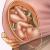 Behandling av hemorrojder under graviditeten hemma: rekommendationer och tips